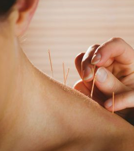 Local SEO Guide for Acupuncturists